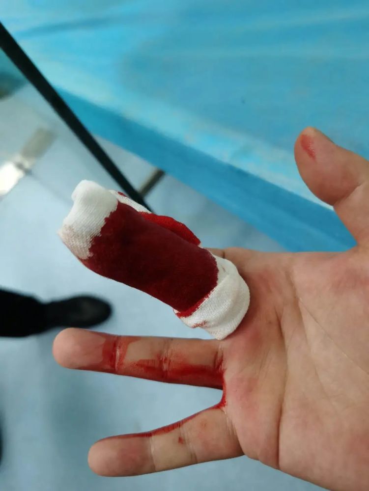 郑潇然这一跤摔得漂亮