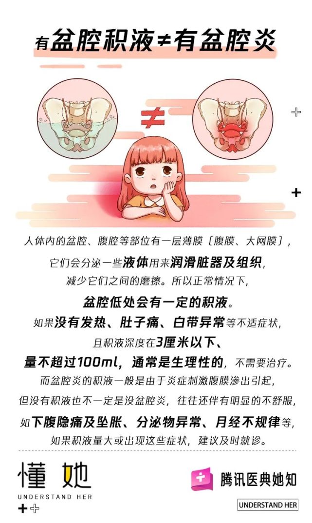 盆腔积液不治疗会导致盆腔炎吗