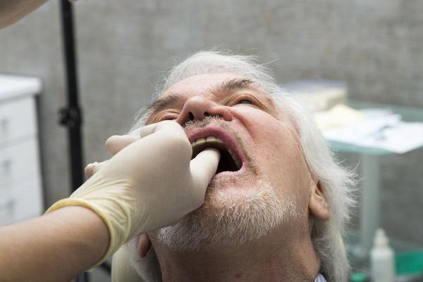 经常嚼槟榔给身体带来哪些异样可能损害口腔功能