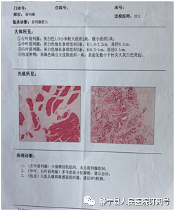 患者psa46ng/ml,行超声引导下经会阴前列腺穿刺活检术,术后病理回报