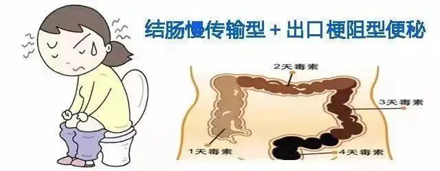 你有没有受便秘折磨小编带你从肠计议