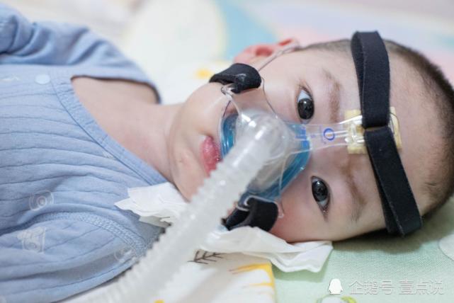 男孩出生半年后变成了象鼻宝宝要靠打针维持生命