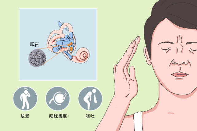 耳石症症状有哪些表现图片