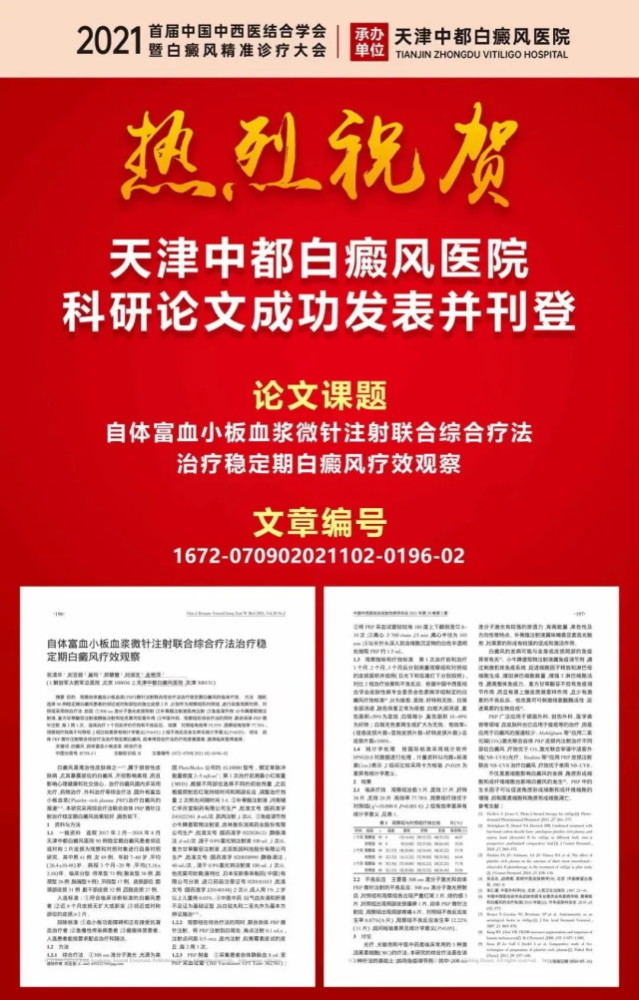 热烈祝贺 天津中都白癜风医院科研论文成功发表并刊登 腾讯新闻