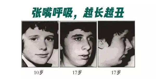 别让口呼吸成为孩子颜值与智力的杀手