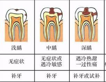 看齲齒牙醫怎麼治