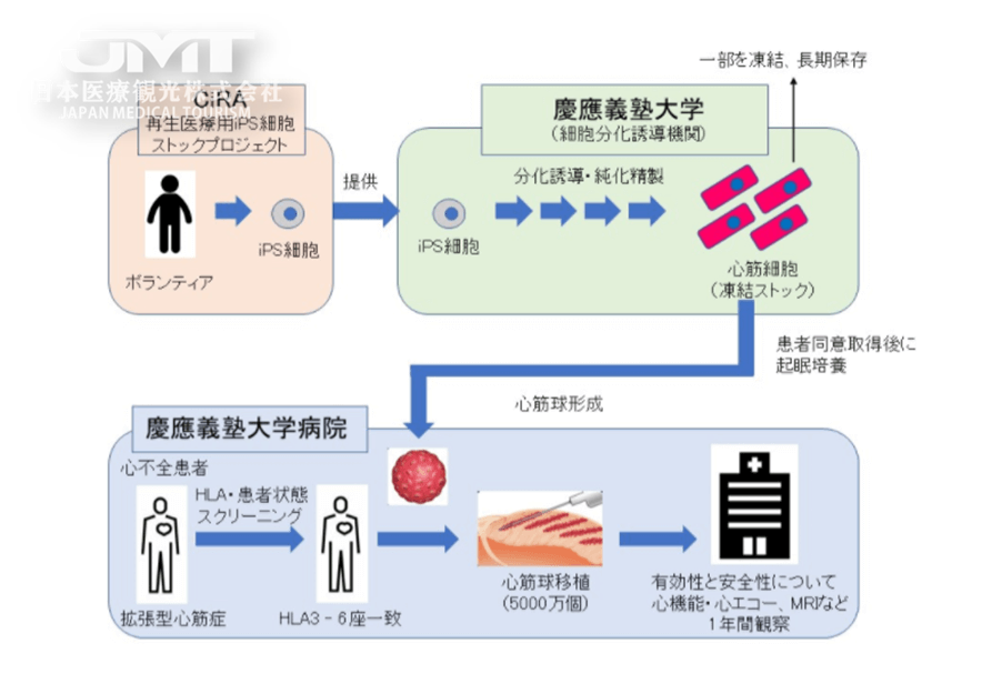 Ips心肌细胞移植日本最新研究进程 腾讯新闻