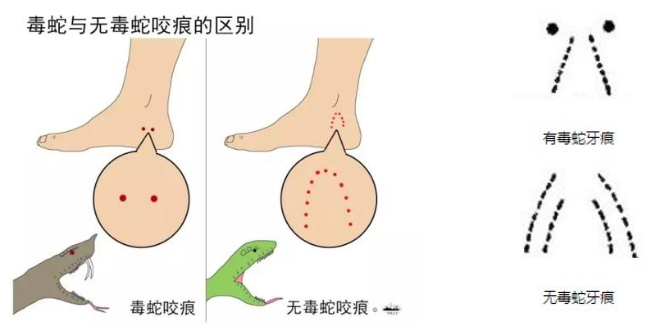 注意!罗定1岁幼童在家门口玩耍 竟被青竹蛇咬伤