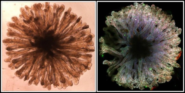 科學家在人造迷你腎臟器官研發方面取得重大進展