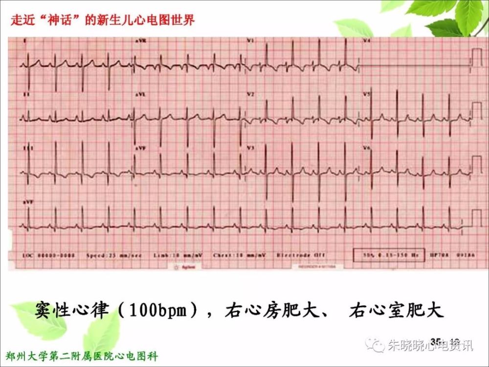 鄭州大學第二附屬醫院心電圖科李世峰