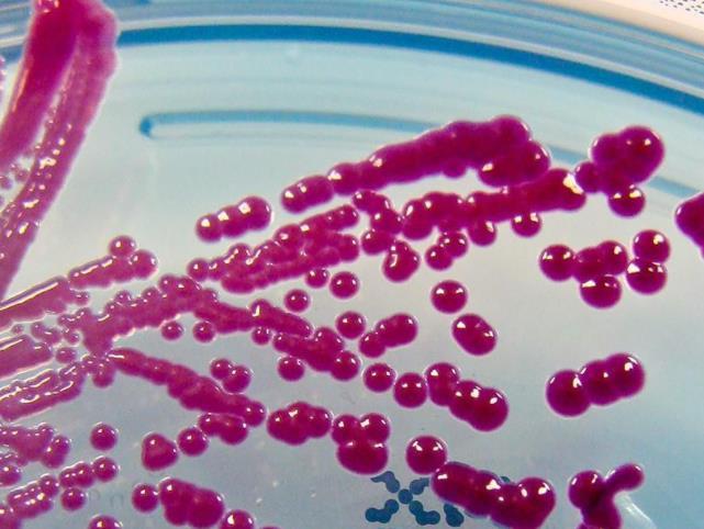 培养基上生长的粘质沙雷菌(图片来源:美国史密森学会)这两种病原体