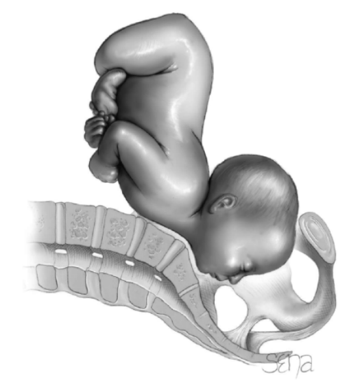 妇产基本功|先露异常的几种类型,你都知道吗?