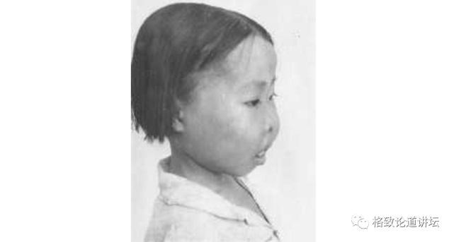 希望与风险并存的医疗技术竟是地中海贫血唯一的治疗方案