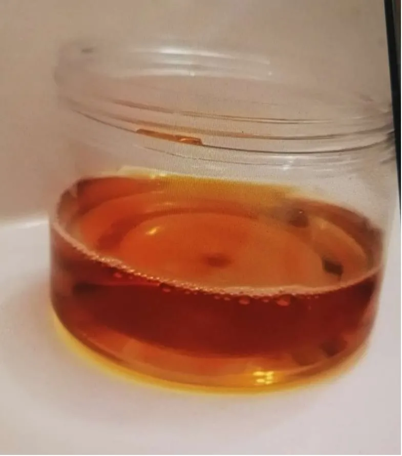 家人慌忙地把他送往医院抢救,经确诊,乐乐患上了蚕豆病!