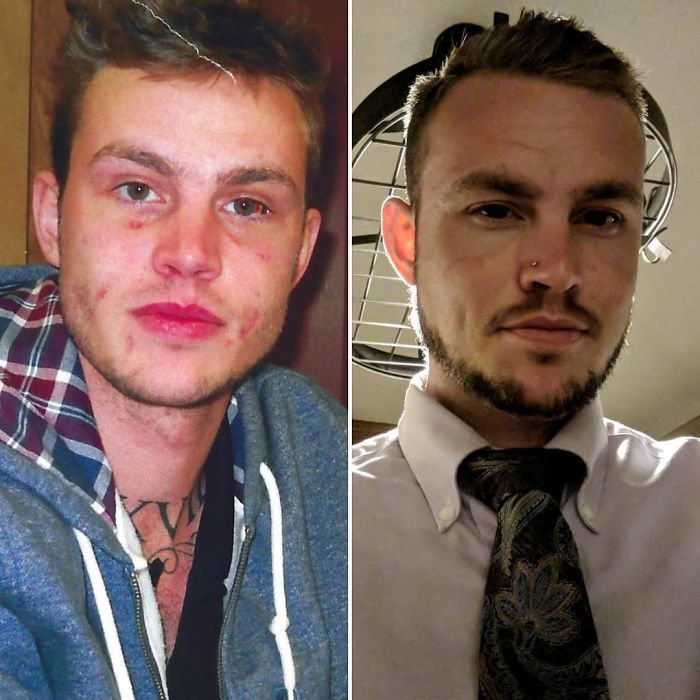 一组男人戒毒前后对比照,吸毒后身体枯瘦如柴,脸部凹陷瘫痪