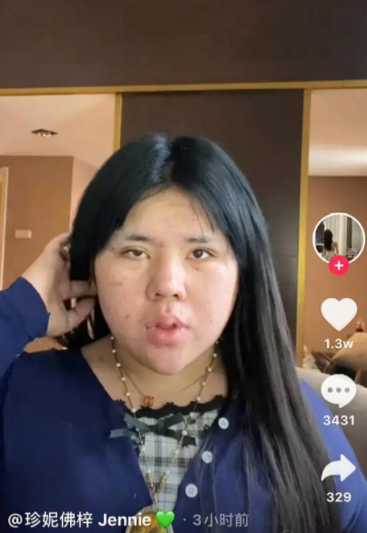 男网红珍妮佛梓后悔整容,呼吁拒绝容貌焦虑,却又准备