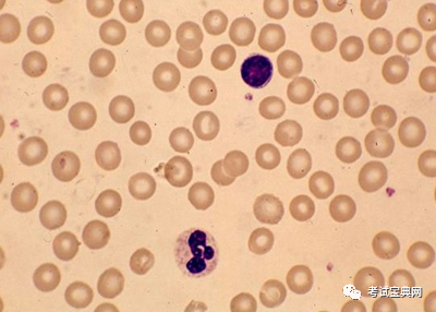 再生障碍性贫血