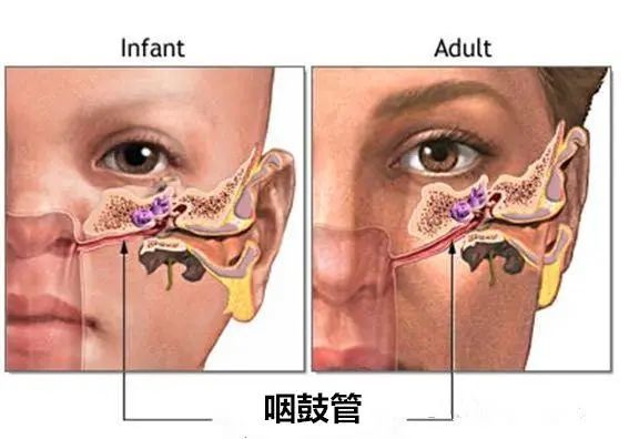 耳朵积液穿刺手术图解图片