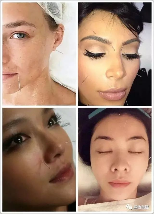 为什么明星那么有钱非把自己整成包子脸石头脸硅胶脸像石块一样无法