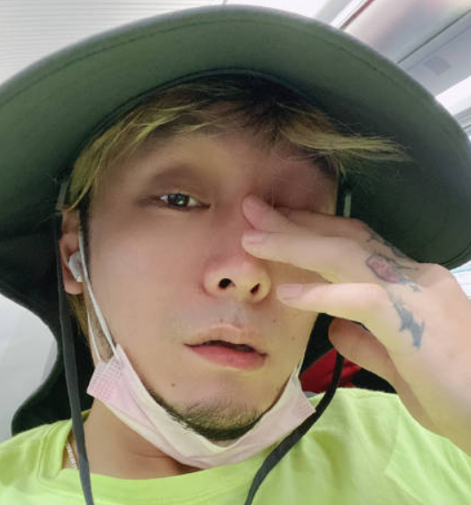 歌手徐真真全身二级深度烧伤,住所被烧毁,都是香薰蜡烛惹的祸_腾讯