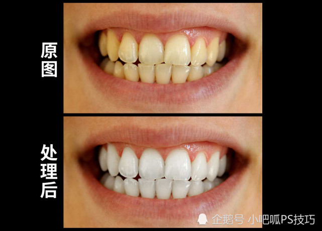 ps教程牙齿黄不敢笑教你一招变白