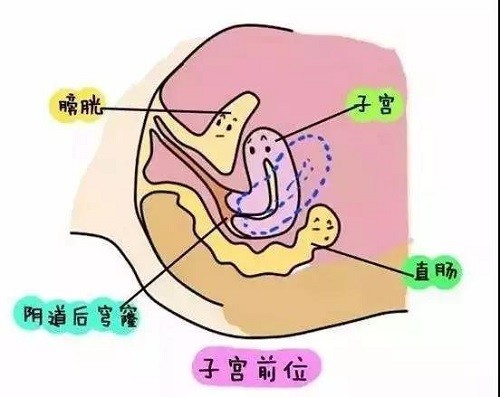 子宫位置也会影响受孕能力三种子宫类型你需要了解