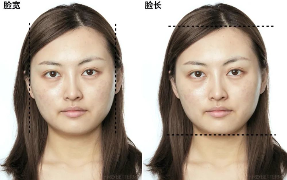 实际上就是因为从整体脸型来看,圆脸的脸宽接近于脸长,同时又没什么