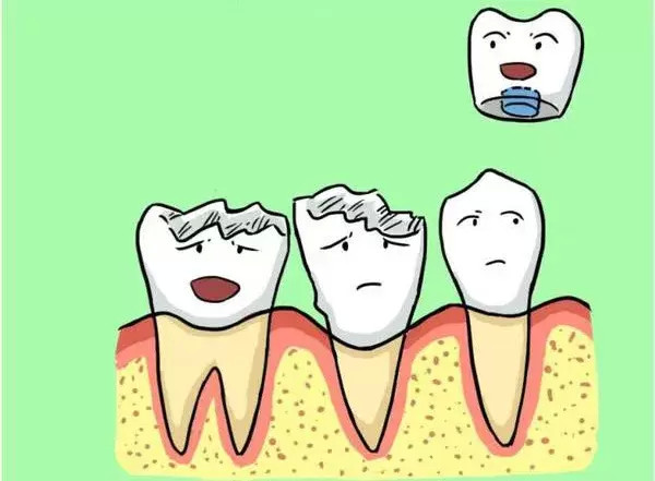 拔掉是不可能的!论残牙根正确的处理方式