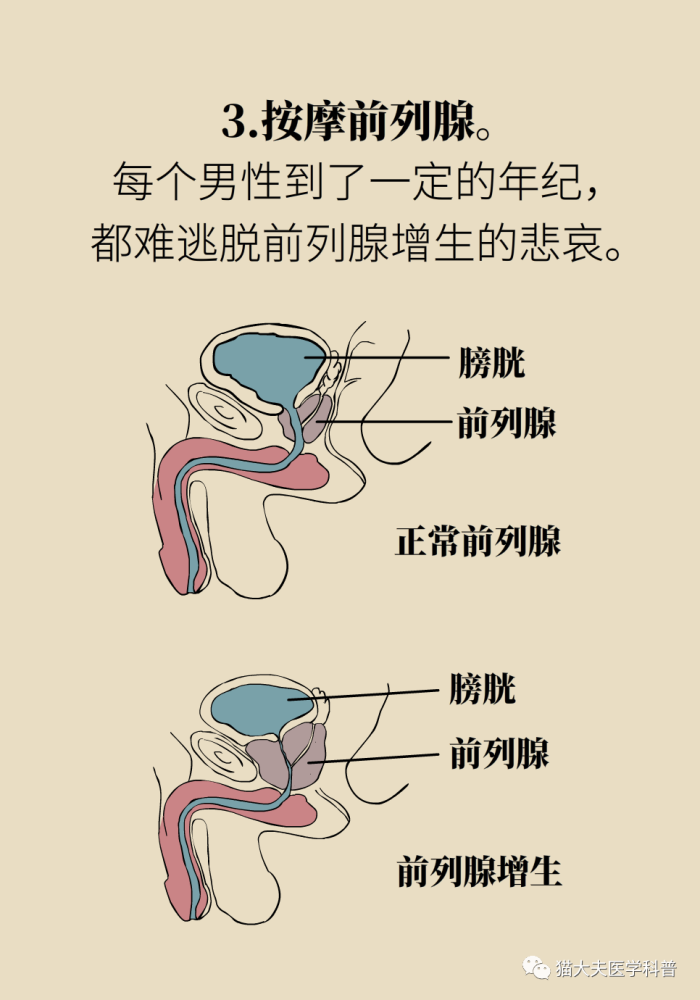 "一松一紧",超火的提肛运动到底有什么好处?