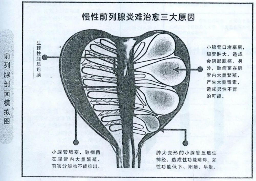 久坐憋尿经常骑车你们考虑过前列腺的感受吗