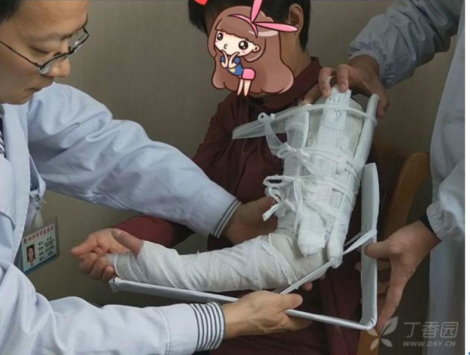 当心!掰手腕也能导致骨折!_腾讯新闻