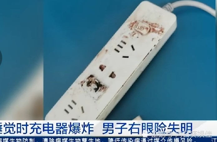睡觉时充电器爆炸险失明!