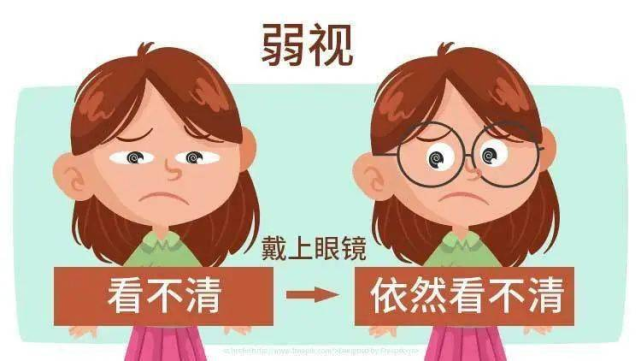 近3个月在兰州爱尔视功能训练的坚持 换来弱视患儿的光明未来(图1)