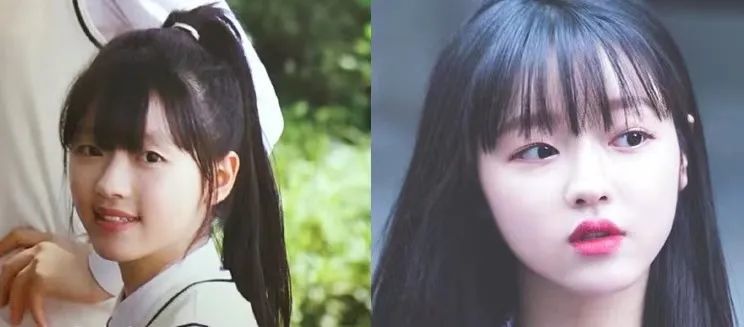 有声yooa直面整容疑惑解释易浮肿体质的爱豆苦衷