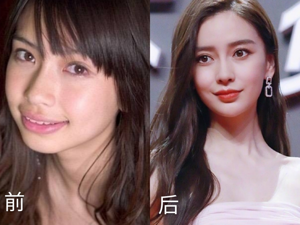 牙齿正畸能给人带来多大的变化?