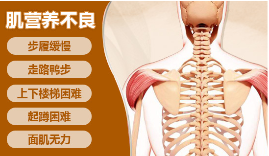 伴有非常輕微的dmd肌營養不良症狀,包括疲勞,ck增高,輕度肌肉無力和