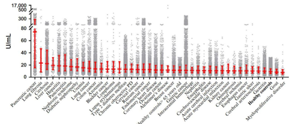 Ca199升高数倍 癌症 千万别忽视这5种可能 全网搜 Ca199升高数倍 癌症 千万别忽视这5种可能 全网搜
