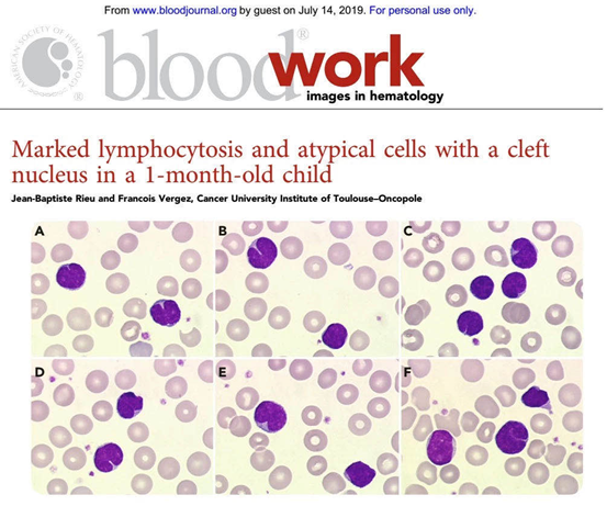 别怕,小紫帽来一探究竟!