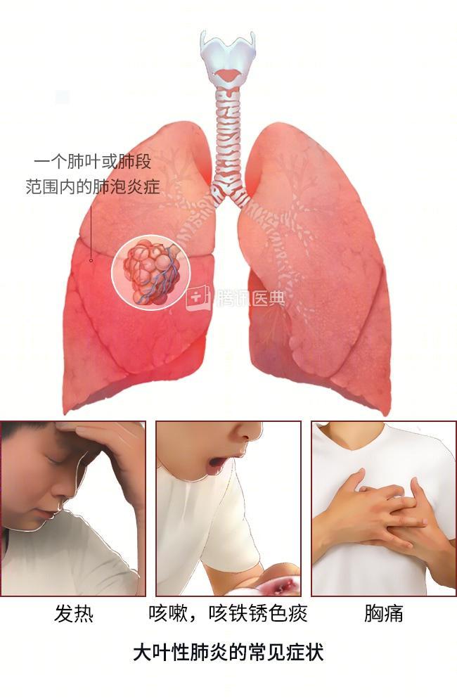 孩子咳嗽两个多月都不好医生让我试试给孩子肺洗澡