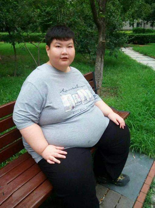 14岁男孩长到了300斤,一天吃七顿饭,却还是很饿