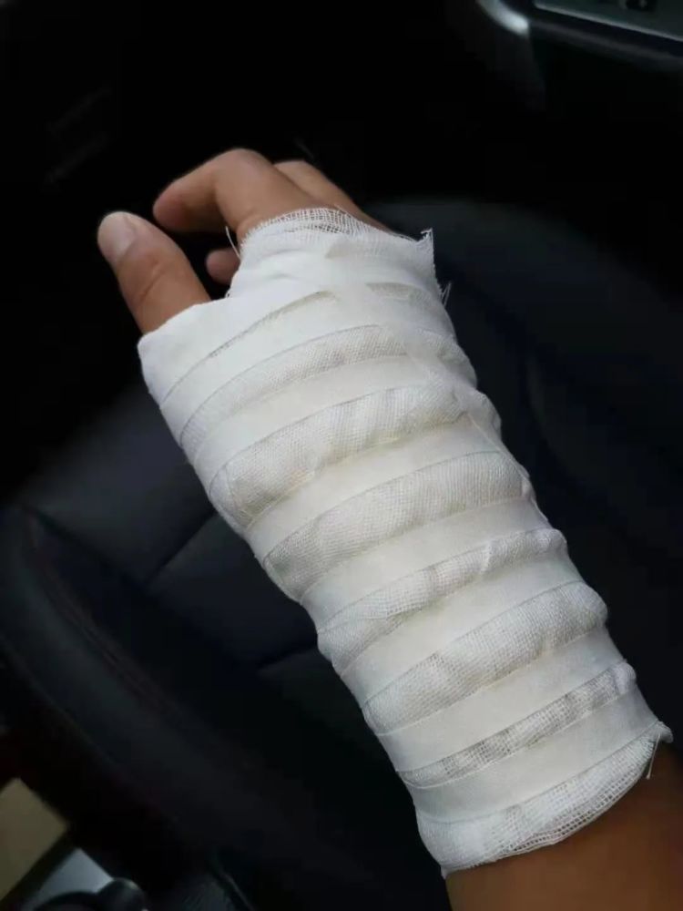 晒伤,擦伤,涂点药继续训练.