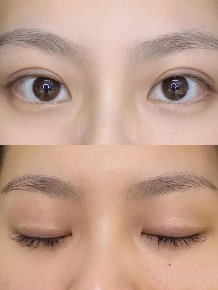 喂~你们要的日式无痕双眼皮攻略来啦