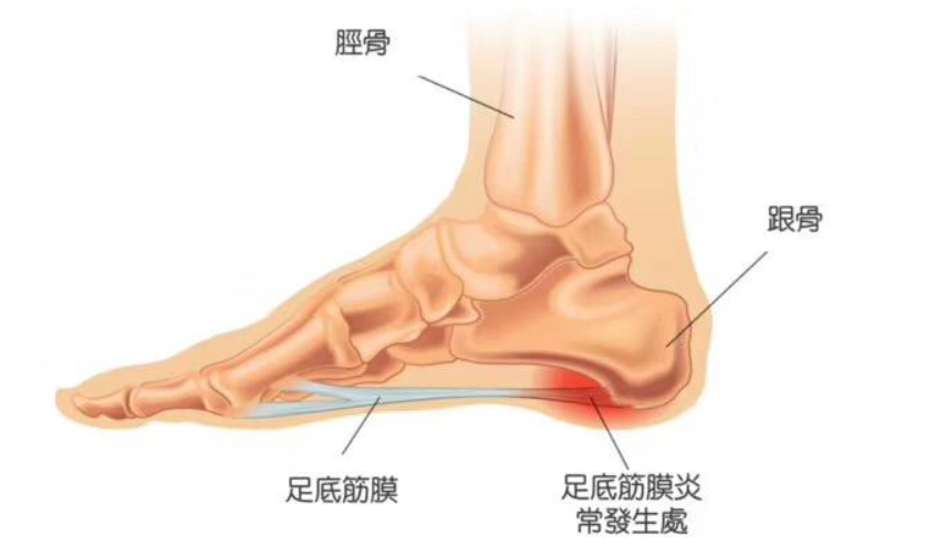 脚后跟图片结构图图片