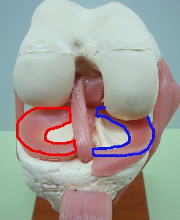 半月板损伤的禁忌