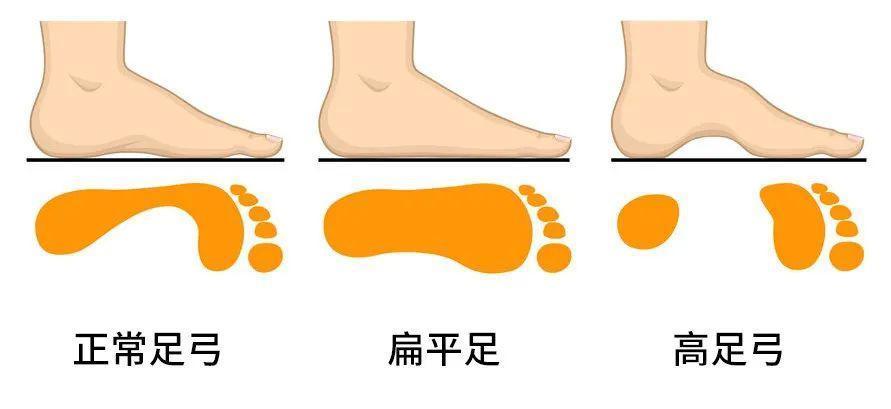 女人衰老从脚开始 如果你脚上有这些特征 衰老开始了 腾讯新闻