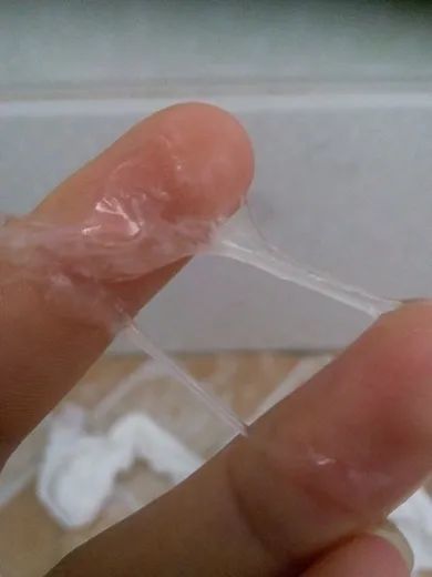 阴道流出来白色的东西?别拒绝,女人都应该看看!_腾讯新闻