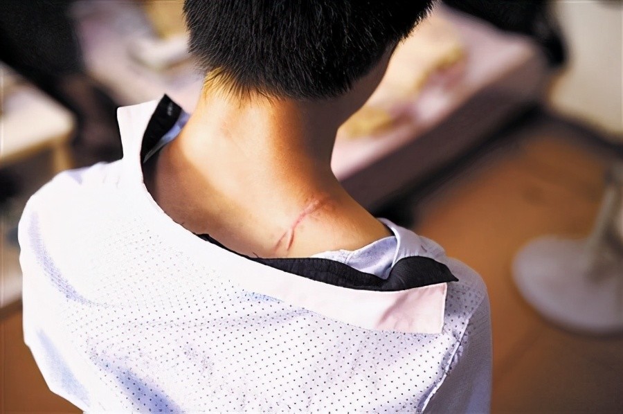 因救全车人错过高考,江西"夺刀"少年,后来怎么样了?