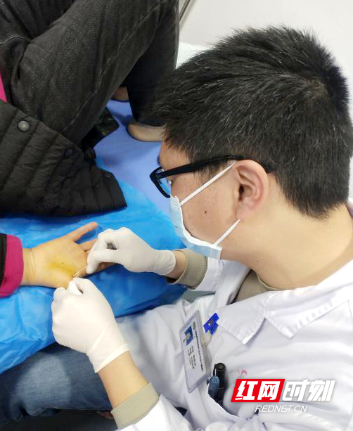 小身材大作为长沙市中医医院小针刀治疗腱鞘炎