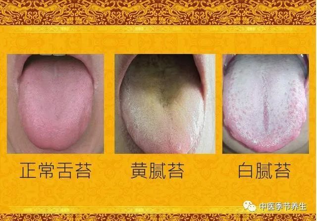 舌苔发黄是什么原因 中医望舌调养舌象 腾讯新闻