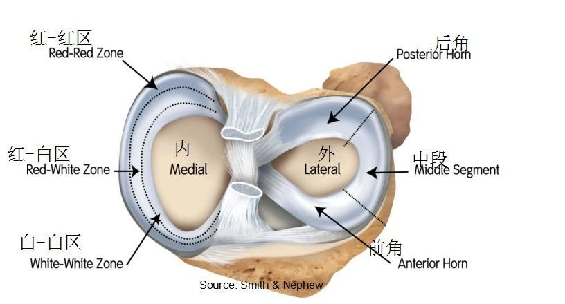 外侧半月板呈"o" 形,中后1/3处有腘肌腱将半月板和关节囊隔开,形成一